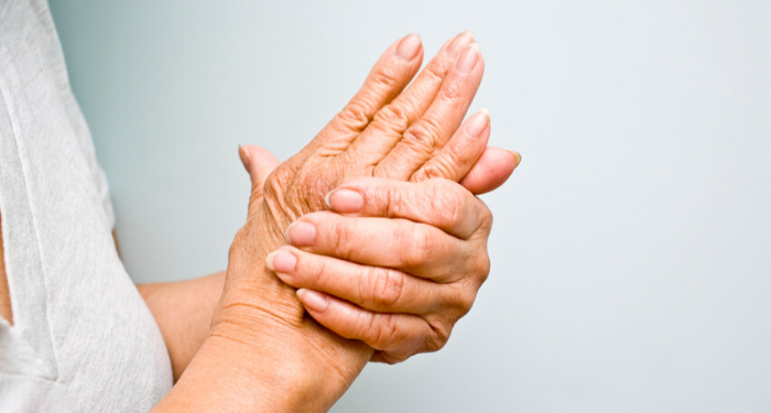Managing Hand & Wrist Arthritis